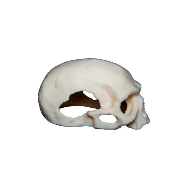 Kraniet – billede 3