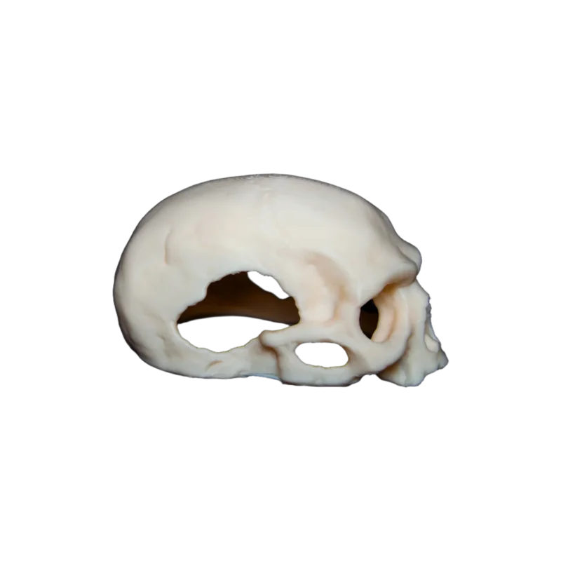 Kraniet – billede 3